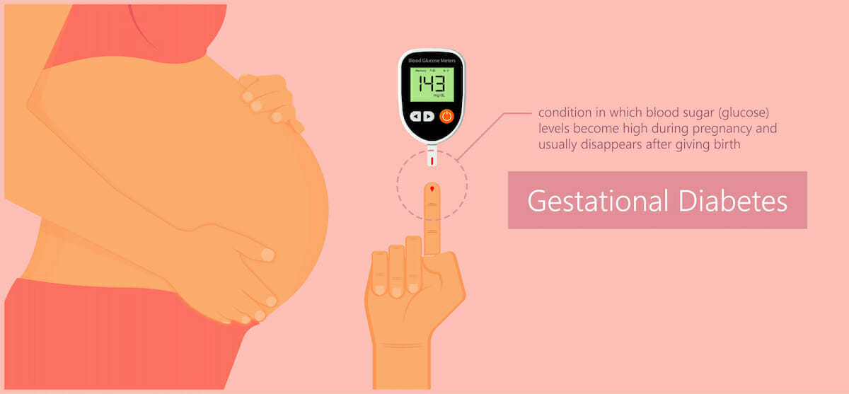 gestational diabetes during pregnancy